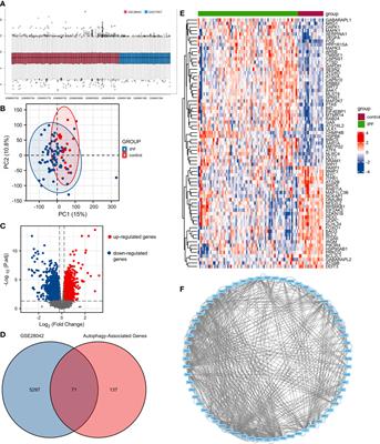 Development and validation of the prognostic model based on autophagy-associated genes in idiopathic pulmonary fibrosis